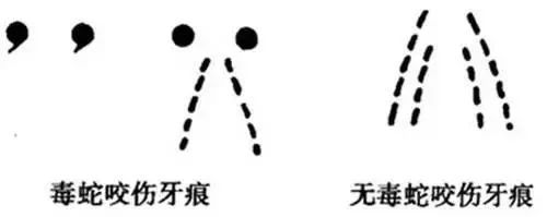 被蛇咬傷怎么辦？ 福德醫(yī)院教你毒蛇咬傷急救指南